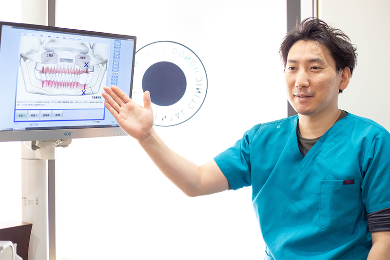 インプラント治療について